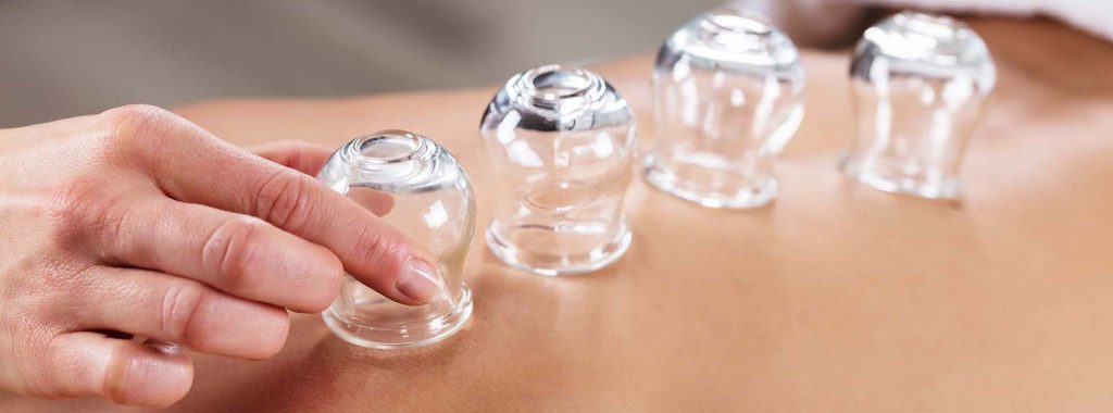 Cupping therapy